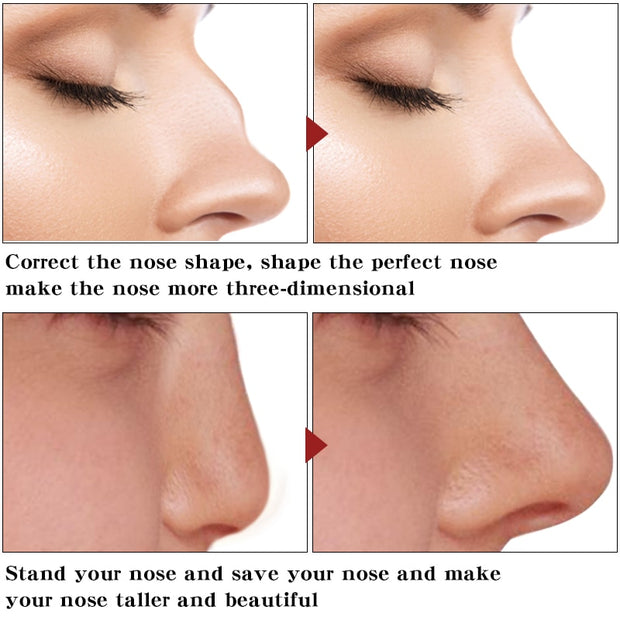 Nose Up Heighten Rhinoplasty Oil