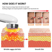 EMS Skin Rejuvenation Radio Frequency Facial Massager