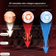 EMS Skin Rejuvenation Radio Frequency Facial Massager